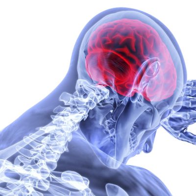 fisioterapia neurologica